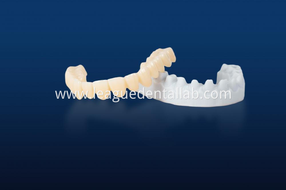 Full zirconia